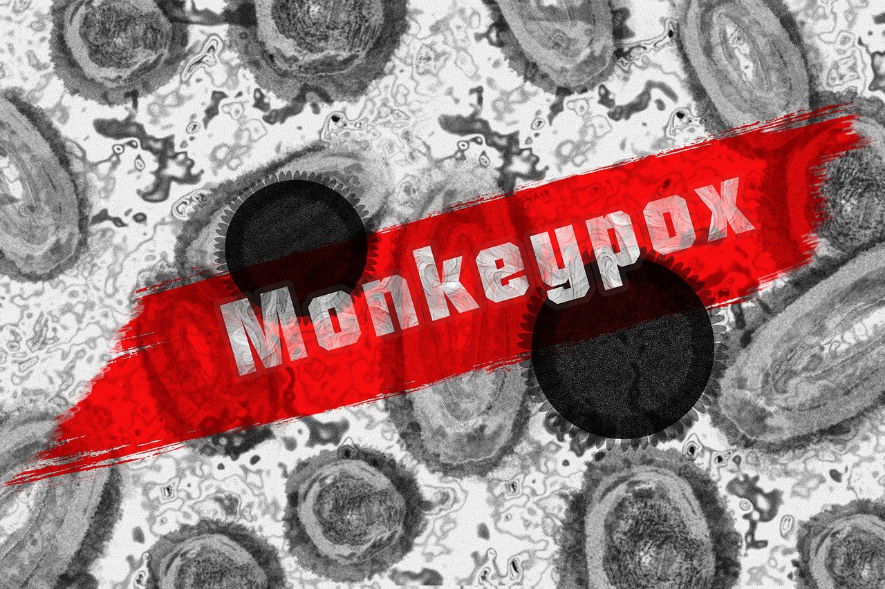 Cegah Penularan Cacar Monyet (Monkeypox), Begini Caranya...