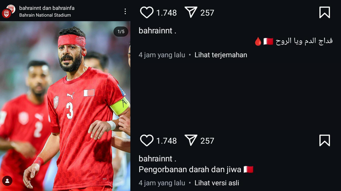 Mencoba 'Playing Victim', Instagram Timnas Bahrain Unggah Cedera Kepala Pemain Pasca Laga Kontra Indonesia!