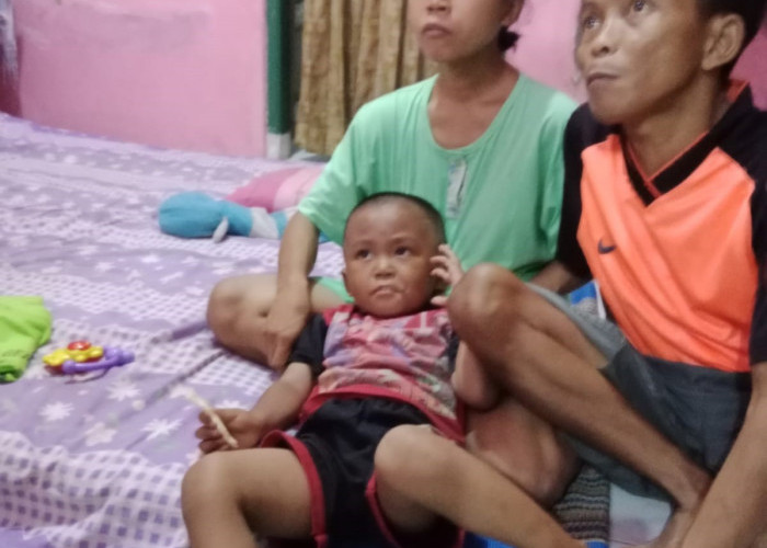 Butuh Bantuan, Keluarga Kembar Siam Dirujuk ke RSHS Bandung