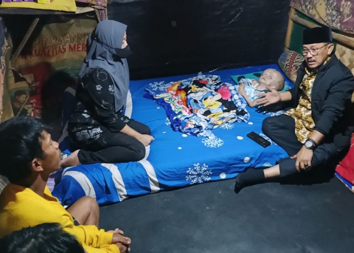 Kunjungi Bocah Penderita Hydrocepallus, Ketua DPRD Indramayu Berikan Semangat dan Motivasi 